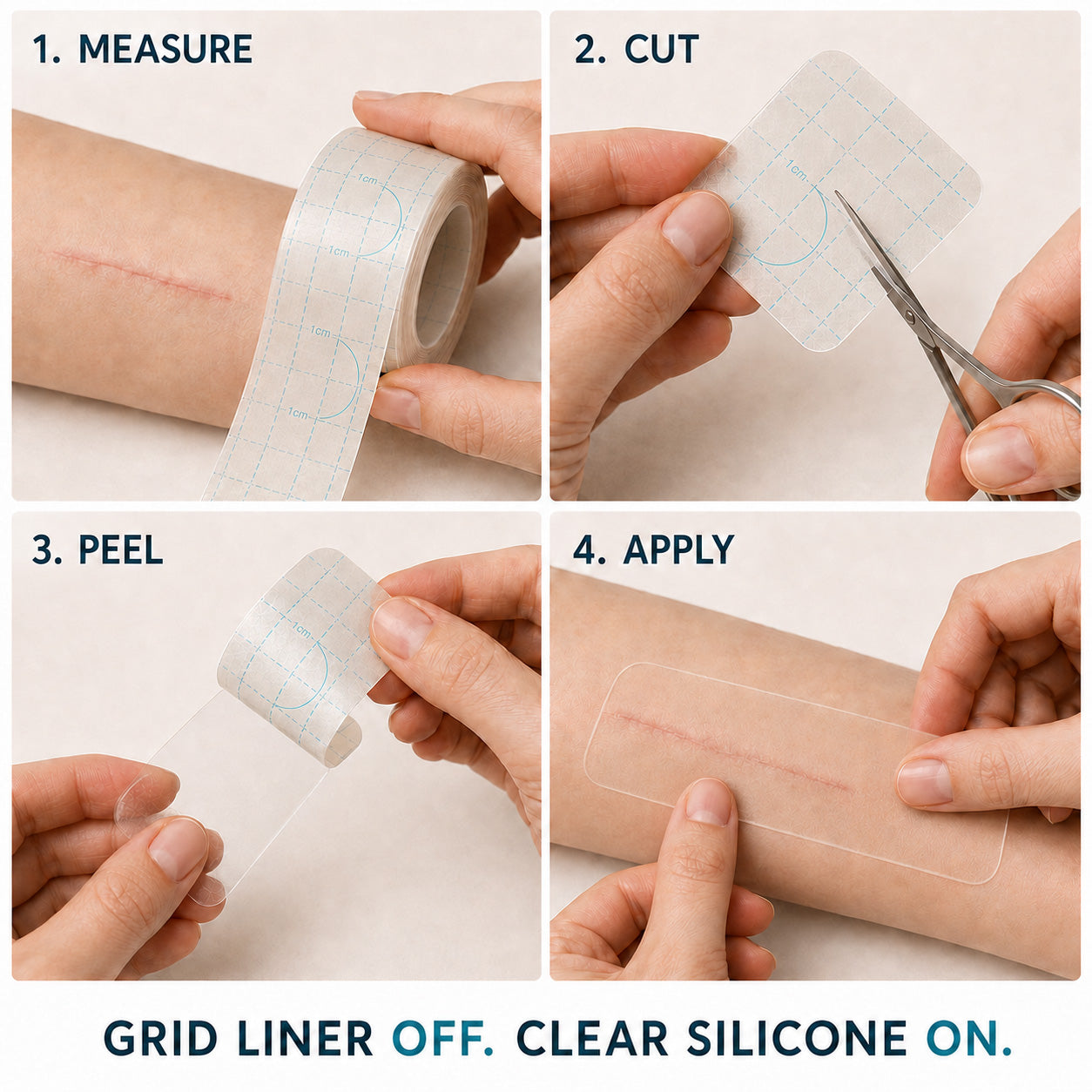👩⚕️👩⚕️TRILUMIA® SILICONE SCAR THERAPY ROLL Help Soften, Flatten & Improve the Appearance of Raised Scars