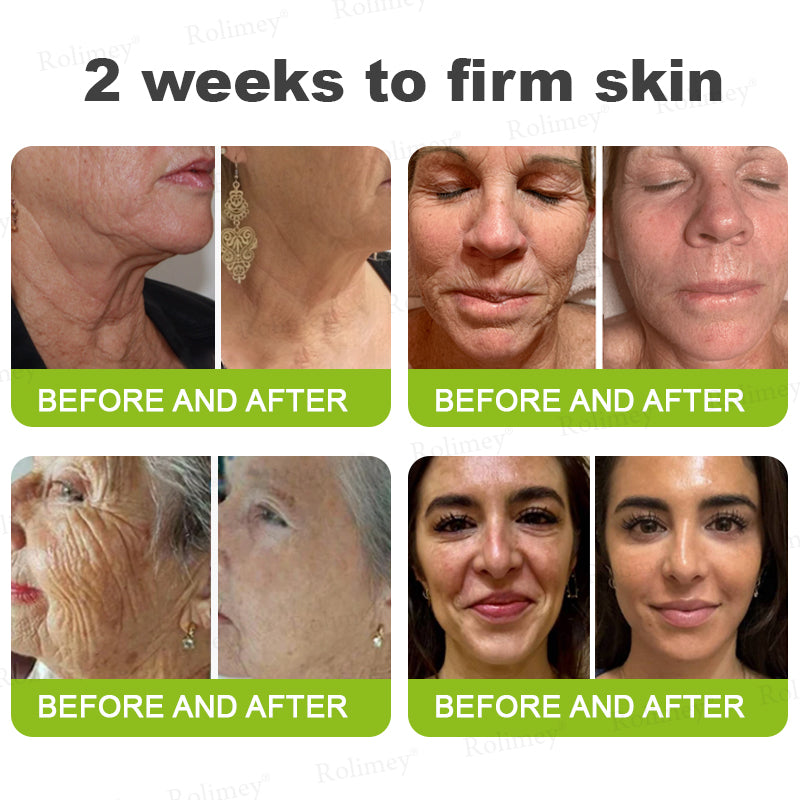 👨‍⚕️👨‍⚕️Made and shipped from the USA 💫Rolimey® Botox & Vita-A Retinol Shot Wrinkle-Lift Tightening cream - Last Day Promotion 50% OFF