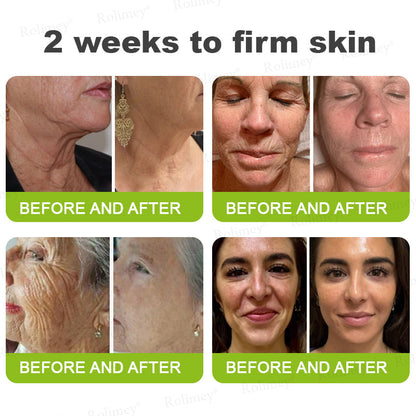👨‍⚕️👨‍⚕️Made and shipped from the USA 💫Rolimey® Botox & Vita-A Retinol Shot Wrinkle-Lift Tightening cream - Last Day Promotion 50% OFF