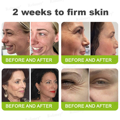 👨‍⚕️👨‍⚕️Made and shipped from the USA 💫Rolimey® Botox & Vita-A Retinol Shot Wrinkle-Lift Tightening cream - Last Day Promotion 50% OFF