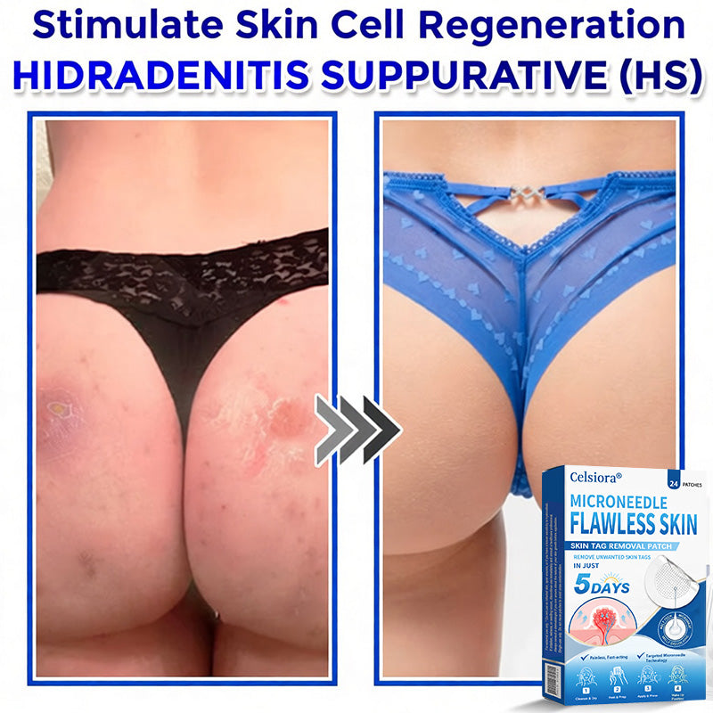 👨‍⚕️🎁Celsiora® 2-in-1 Microneedle & Hydrocolloid Patch | Raised Moles,Acne, Flat Warts & Skin Tags Remover | Improves Wrinkles, Scars & Blemishes | Invisible Pimple Patches for Face & Body | 24 Count