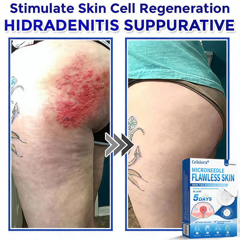 👨‍⚕️🎁Celsiora® 2-in-1 Microneedle & Hydrocolloid Patch | Raised Moles,Acne, Flat Warts & Skin Tags Remover | Improves Wrinkles, Scars & Blemishes | Invisible Pimple Patches for Face & Body | 24 Count