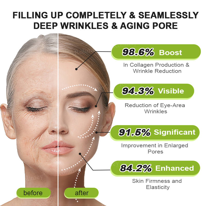 👨‍⚕️👨‍⚕️Made and shipped from the USA 💫Rolimey® Botox & Vita-A Retinol Shot Wrinkle-Lift Tightening cream - Last Day Promotion 50% OFF