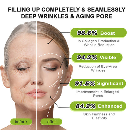👨‍⚕️👨‍⚕️Made and shipped from the USA 💫Rolimey® Botox & Vita-A Retinol Shot Wrinkle-Lift Tightening cream - Last Day Promotion 50% OFF