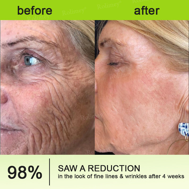 👨‍⚕️👨‍⚕️Made and shipped from the USA 💫Rolimey® Botox & Vita-A Retinol Shot Wrinkle-Lift Tightening cream - Last Day Promotion 50% OFF