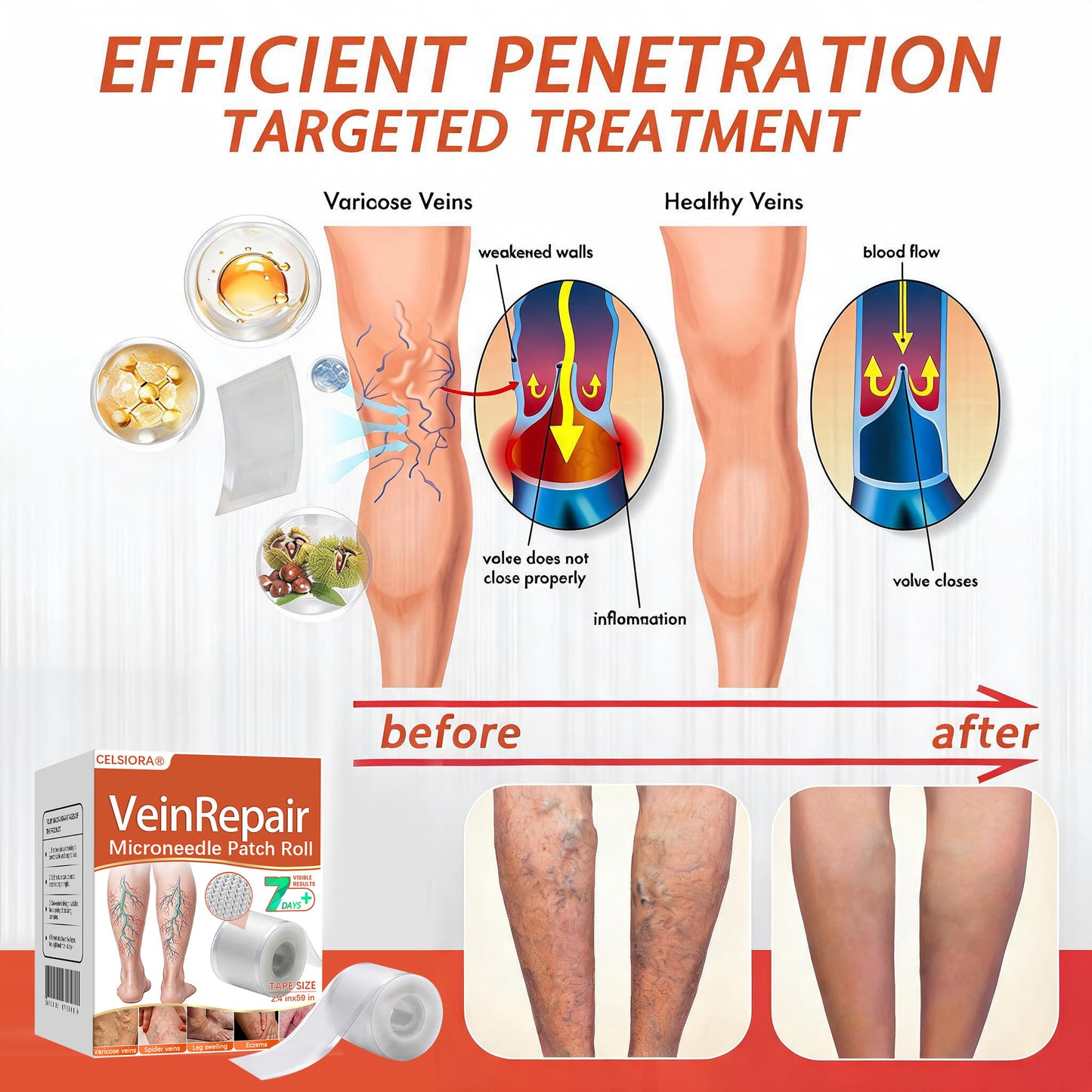 🧚Celsiora® Vein Ease Microneedle Care Patch - Last Day Promotion 50% OFF