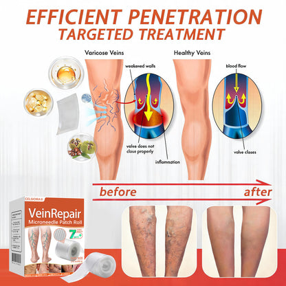🧚Celsiora® Vein Ease Microneedle Care Patch - Last Day Promotion 50% OFF