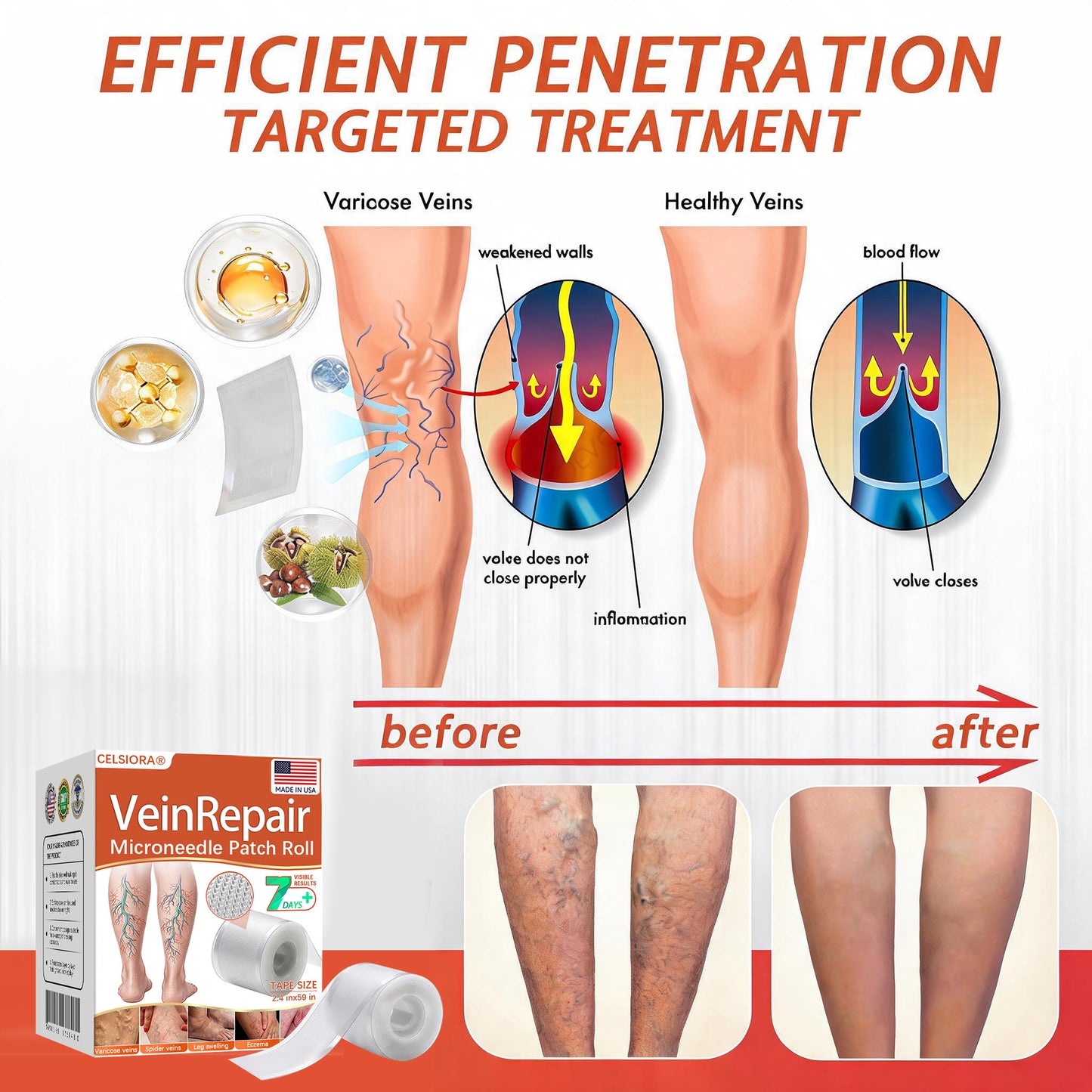 🌿🥇Celsiora® Vein Ease Microneedle Care Patch(For Spider Veins, Varicose Veins, Swelling & Leg Fatigue) - Last Day Promotion 50% OFF