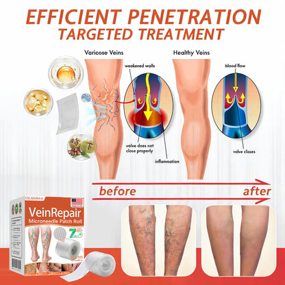 🌿🥇Celsiora® Vein Ease Microneedle Care Patch(For Spider Veins, Varicose Veins, Swelling & Leg Fatigue) - Last Day Promotion 50% OFF