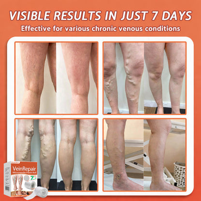 🧚Celsiora® Vein Ease Microneedle Care Patch - Last Day Promotion 50% OFF