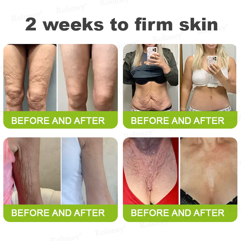 👨‍⚕️👨‍⚕️Made and shipped from the USA 💫Rolimey® Botox & Vita-A Retinol Shot Wrinkle-Lift Tightening cream - Last Day Promotion 50% OFF