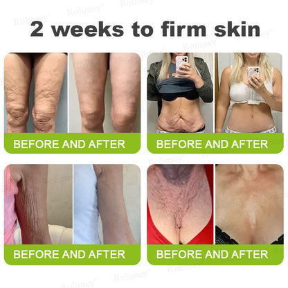 👨‍⚕️👨‍⚕️Made and shipped from the USA 💫Rolimey® Botox & Vita-A Retinol Shot Wrinkle-Lift Tightening cream - Last Day Promotion 50% OFF