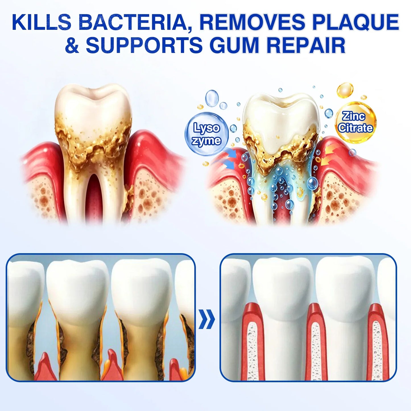 🇺🇸 👨‍⚕️🦷 Evolvion® GumCare Pro Advanced Gum Care Gel