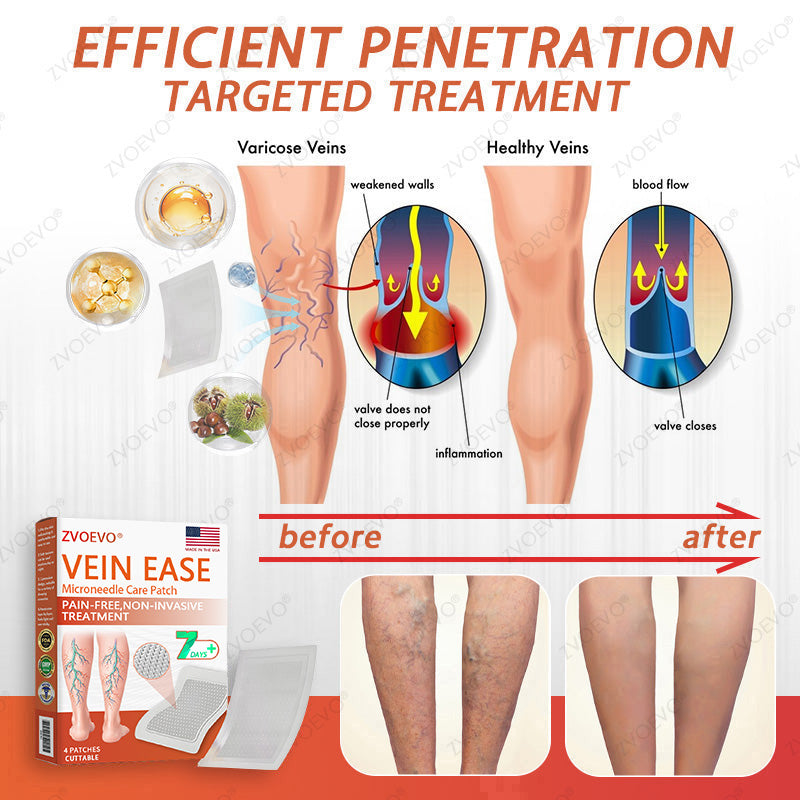 🌿🌟Zvoevo® Vein Ease Microneedle Care Patch(For Spider Veins, Varicose Veins, Swelling & Leg Fatigue) - Last Day Promotion 50% OFF