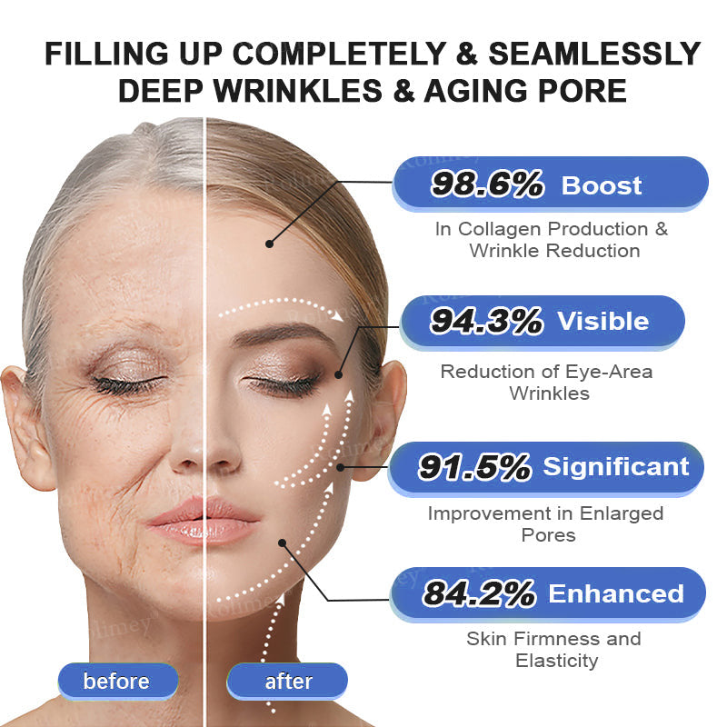 👨‍⚕️🫧Rolimey® NAD+ Retinol Firming & Lifting Cream – For Eye Bags, Dark Circles & Fine Lines | Last Day Sale: 60% OFF