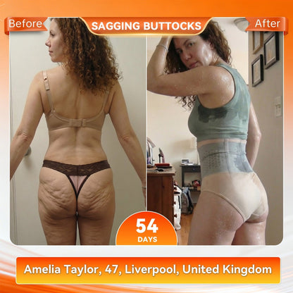 ✅Official US Store 🇺🇸 | Sugoola® 𝐌𝐨𝐫𝐢𝐧𝐠𝐚 & 𝐁𝐞𝐫𝐛𝐞𝐫𝐢𝐧𝐞 4‑In‑1 Micro‑Particle Sculpting & Fat‑Burn Shorts