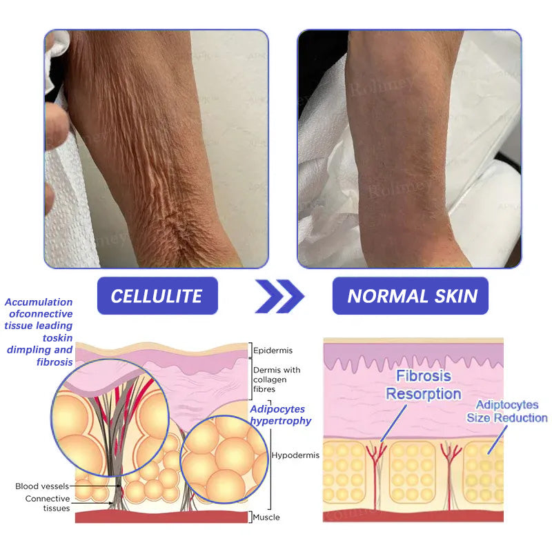 👨‍⚕️👨‍⚕️Rolimey® Biotin(B7) Firming Stick – Targets Aging, Sagging & Fine Lines | Final Day: Save 50%