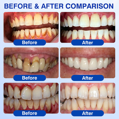 🇺🇸 👨‍⚕️🦷 Evolvion® GumCare Pro Advanced Gum Care Gel