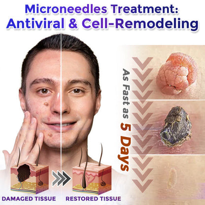 🎉👑Celsiora® Multi-Functional Microneedle Hydrocolloid Patch Roll | Targets Skin Tags, Warts & Stubborn Blemishes