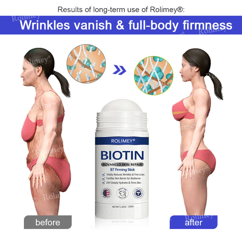 👨‍⚕️👨‍⚕️Rolimey® Biotin(B7) Firming Stick – Targets Aging, Sagging & Fine Lines | Final Day: Save 50%