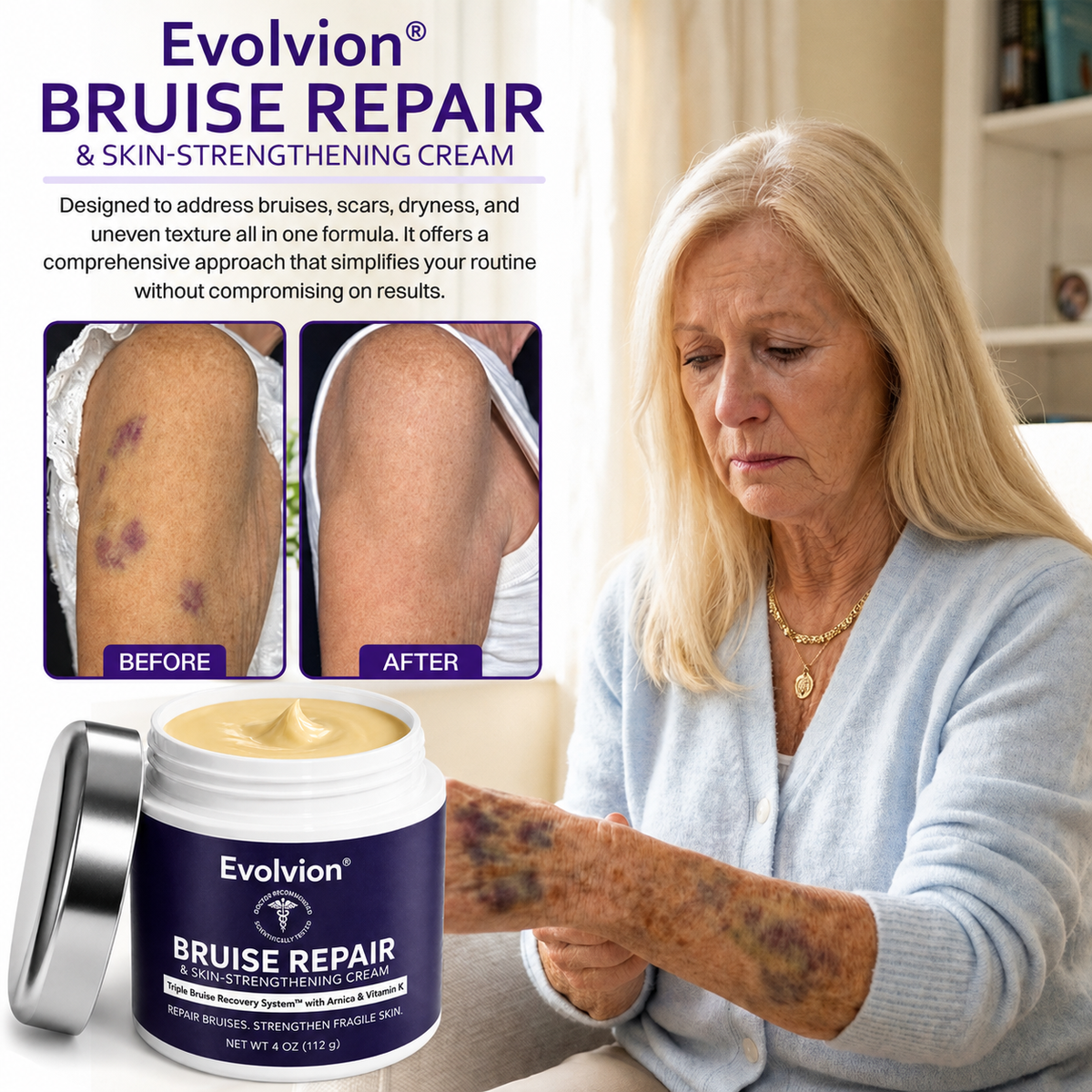 👩‍⚕️Evolvion® Bruise Repair & Skin-Strengthening Cream-Advanced daily care for bruise-prone skin