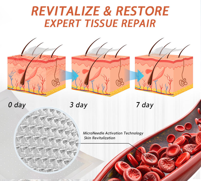 🌿🥇Celsiora® Vein Ease Microneedle Care Patch(For Spider Veins, Varicose Veins, Swelling & Leg Fatigue) - Last Day Promotion 50% OFF