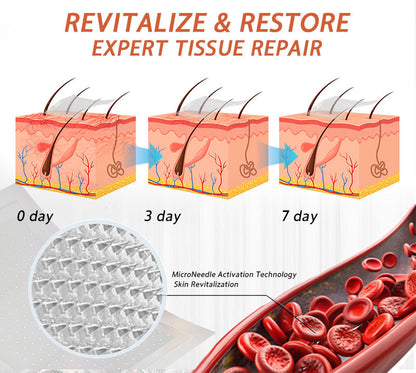 🌿🥇Celsiora® Vein Ease Microneedle Care Patch(For Spider Veins, Varicose Veins, Swelling & Leg Fatigue) - Last Day Promotion 50% OFF