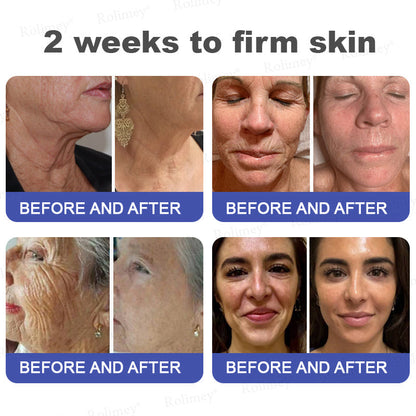 👨‍⚕️👨‍⚕️Rolimey® Biotin(B7) Firming Stick – Targets Aging, Sagging & Fine Lines | Final Day: Save 50%