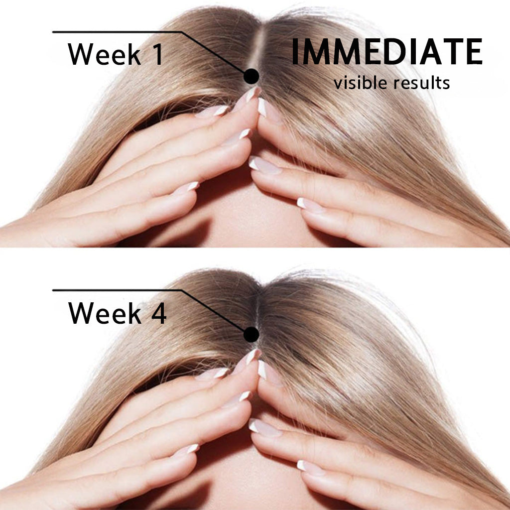 👩‍⚕️👩‍⚕️ Official US Store 🇺🇸 | 🔥Rolimey® Highly Effective Biotin & Rosemary Hair Growth Serum — (🔥 Limited-Time Offer, ⏳ Last Day Promotion 50% OFF)