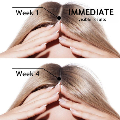 👩‍⚕️👩‍⚕️ Official US Store 🇺🇸 | 🔥Rolimey® Highly Effective Biotin & Rosemary Hair Growth Serum — (🔥 Limited-Time Offer, ⏳ Last Day Promotion 50% OFF)