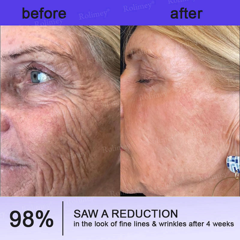 👨‍⚕️👨‍⚕️Rolimey® Biotin(B7) Firming Stick – Targets Aging, Sagging & Fine Lines | Final Day: Save 50%