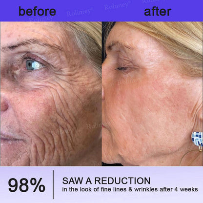 👨‍⚕️👨‍⚕️Rolimey® Biotin(B7) Firming Stick – Targets Aging, Sagging & Fine Lines | Final Day: Save 50%