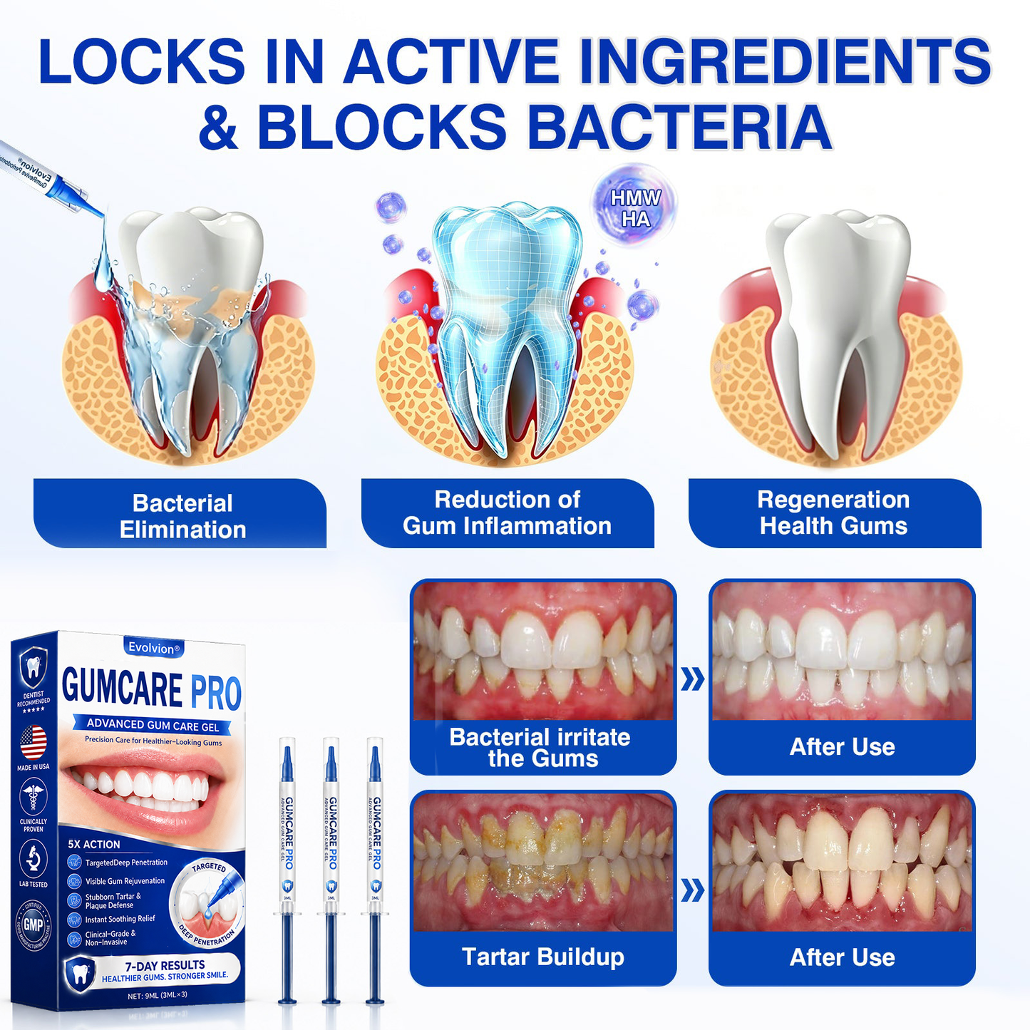 🇺🇸 👨‍⚕️🦷 Evolvion® GumCare Pro Advanced Gum Care Gel