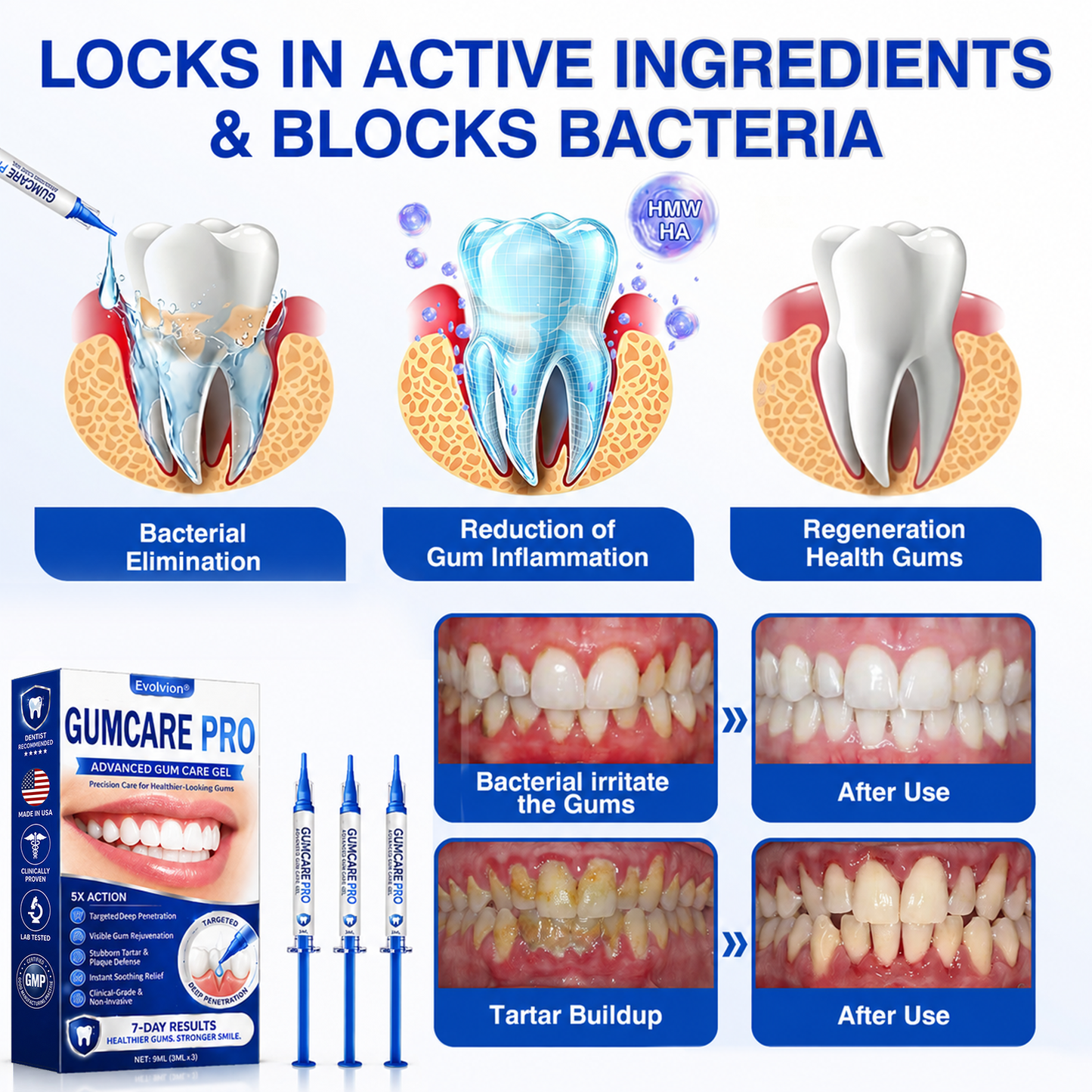 🇺🇸 👨‍⚕️✨ Evolvion® GumCare Pro Advanced Gum Care Gel