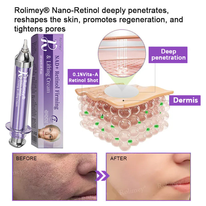 👁️💫Rolimey® NAD+ Retinol Firming & Lifting Cream – For Eye Bags, Dark Circles & Fine Lines | Last Day Sale: 60% OFF
