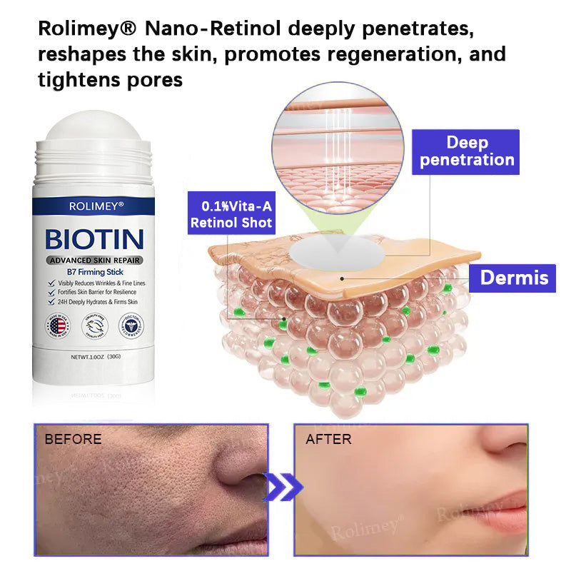👨‍⚕️👨‍⚕️Rolimey® Biotin(B7) Firming Stick – Targets Aging, Sagging & Fine Lines | Final Day: Save 50%