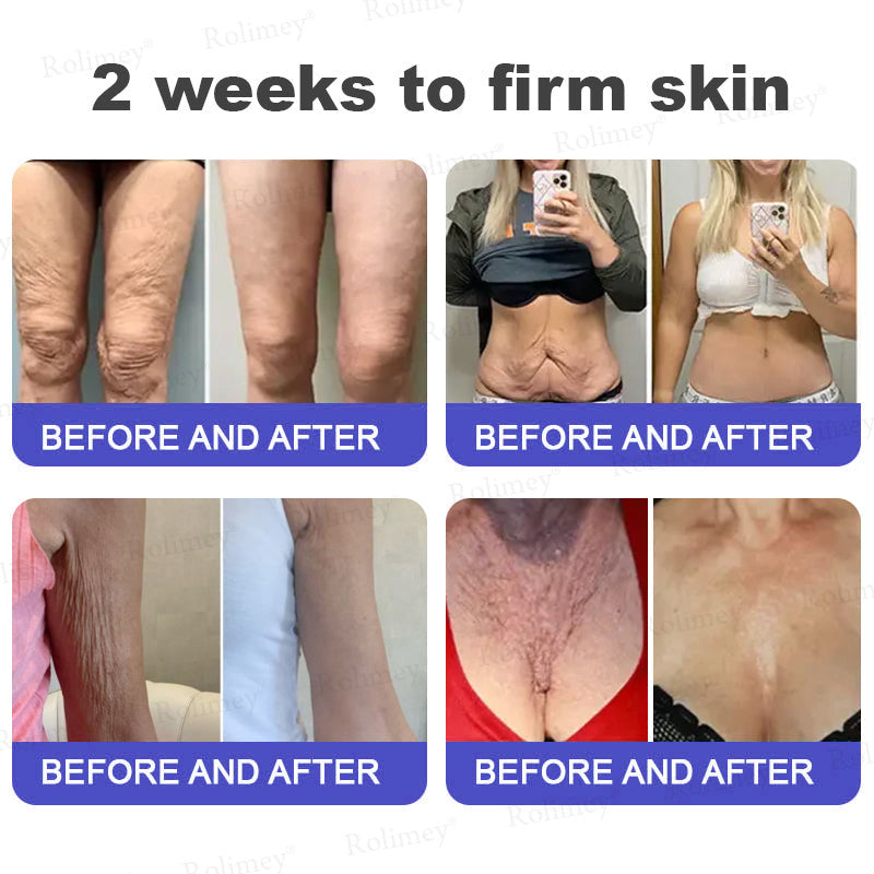 👨‍⚕️👨‍⚕️Rolimey® Biotin(B7) Firming Stick – Targets Aging, Sagging & Fine Lines | Final Day: Save 50%