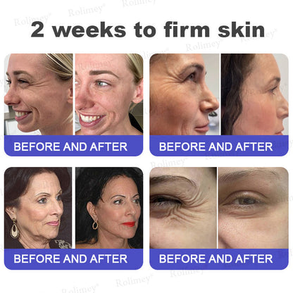👨‍⚕️👨‍⚕️Rolimey® Biotin(B7) Firming Stick – Targets Aging, Sagging & Fine Lines | Final Day: Save 50%